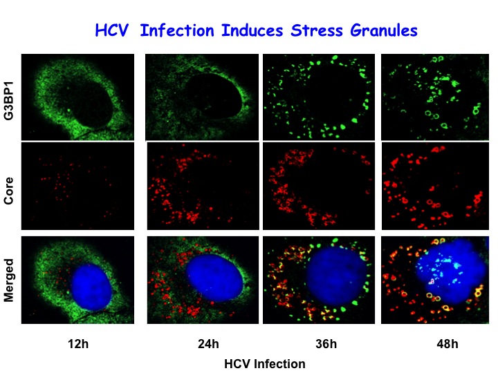 HCV SG.jpgのサムネイル画像